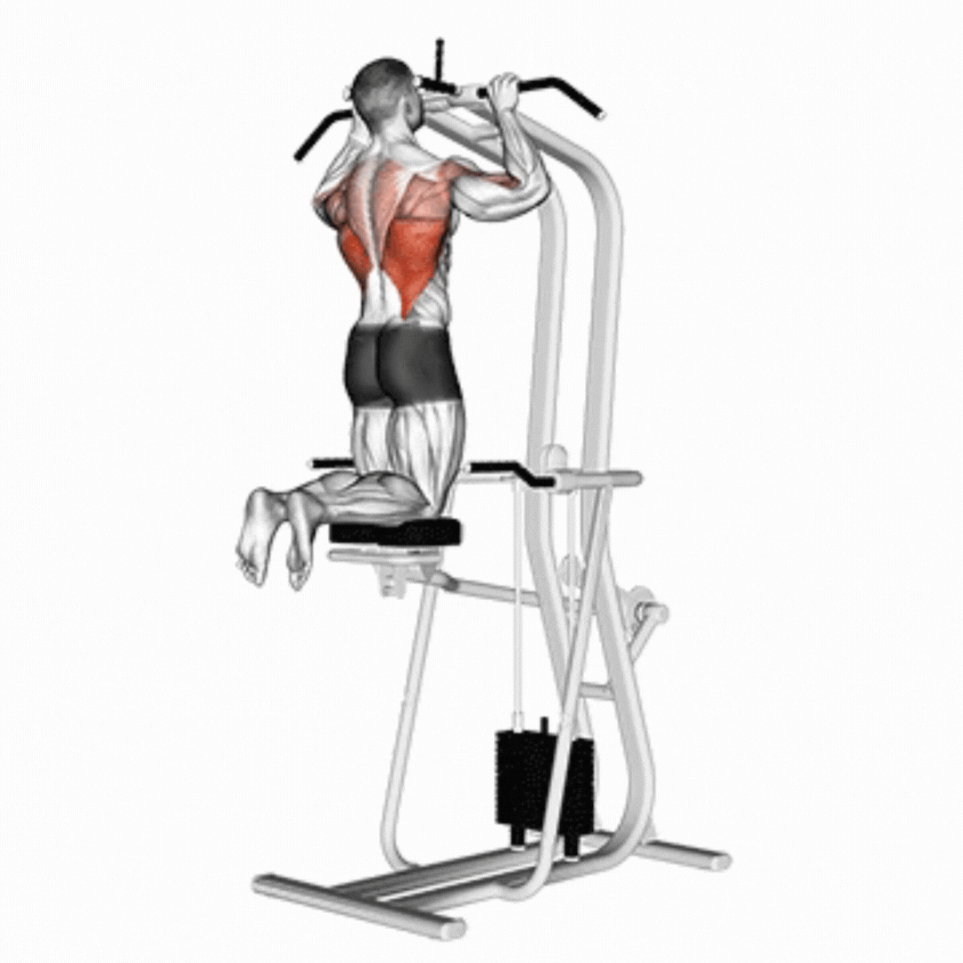 Barra Fixa Assistida